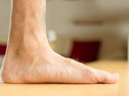 Flat Foot