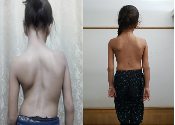 Deformity Correction / Malunion