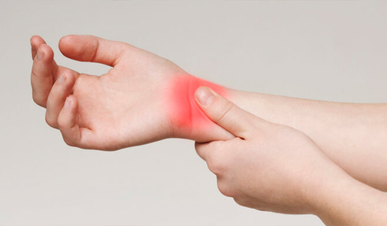 Carpal Tunnel Syndrome