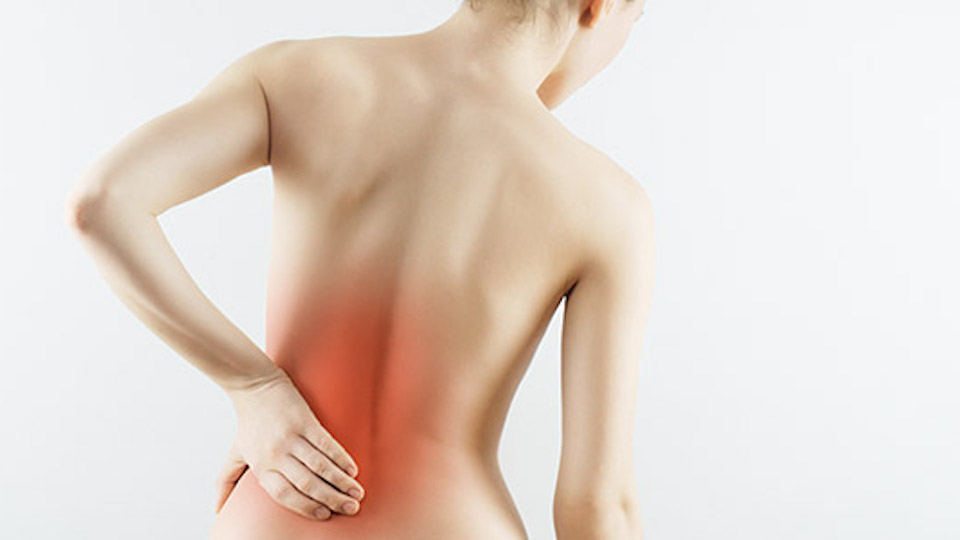Ankylosing Spondylitis