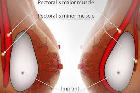 Plastic Surgery treatment in chennai