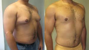 Cosmetic surgery experts Chennai