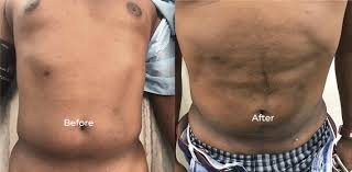 Cosmetic surgery experts Chennai