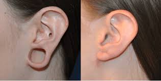 Skin grafting and reconstructive surgery