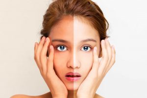 Cosmetology Treatments in chennai