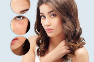 Cosmetology Treatments in chennai