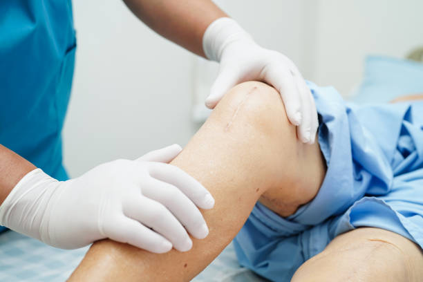 Total Knee/Hip Replacement