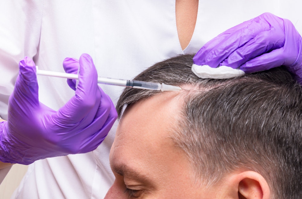PRP for Hair Fall and Skin Rejuvenation  Treatment In chennai