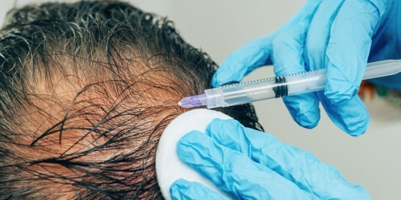 PRP for Hair Fall and Skin Rejuvenation  Treatment In chennai