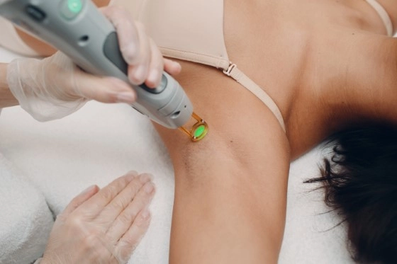 Laser Hair Reduction
